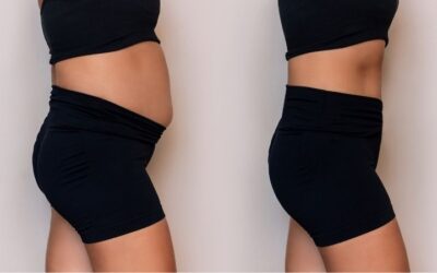 What Causes Bloat?  What helps Bloating?