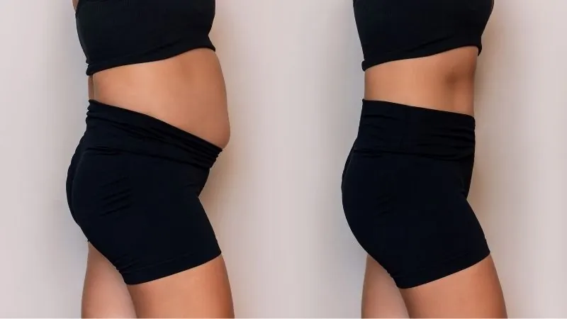 What Causes Bloat? What helps Bloating?