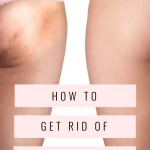 How to get rid of cellulite - Christina Carlyle