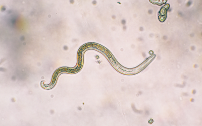 Symptoms of Parasites in Humans