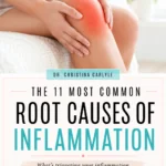 Vertical Pinterest pin featuring a woman holding a red, inflamed knee. Text reads, “The 11 Most Common Root Causes of Inflammation,” with a prompt to learn what may be triggering inflammation and how to address it at the root.