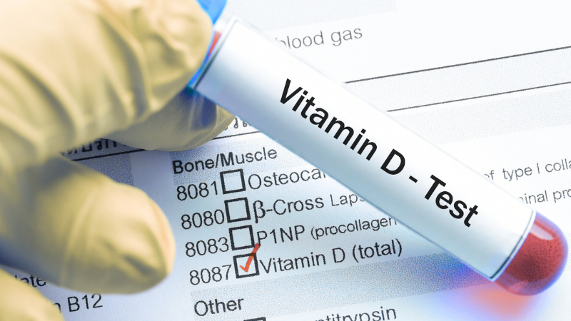 Vitamin D Deficiency lab test