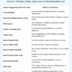 Chart showing what nail changes reveal about health by Dr. Christina Carlyle — vertical ridges, white spots, brittle nails, and more signs of nutrient, thyroid, and gut imbalances.