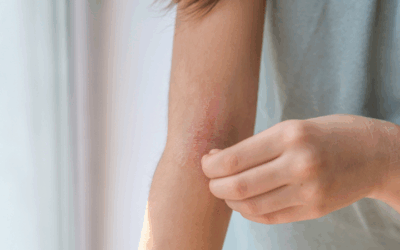 Skin Conditions: What Your Body Is Trying to Tell You