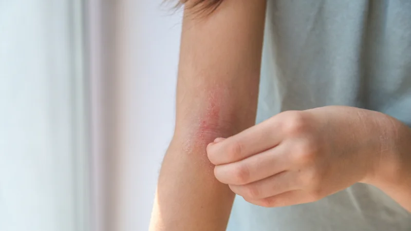 Skin Conditions: What Your Body Is Trying to Tell You