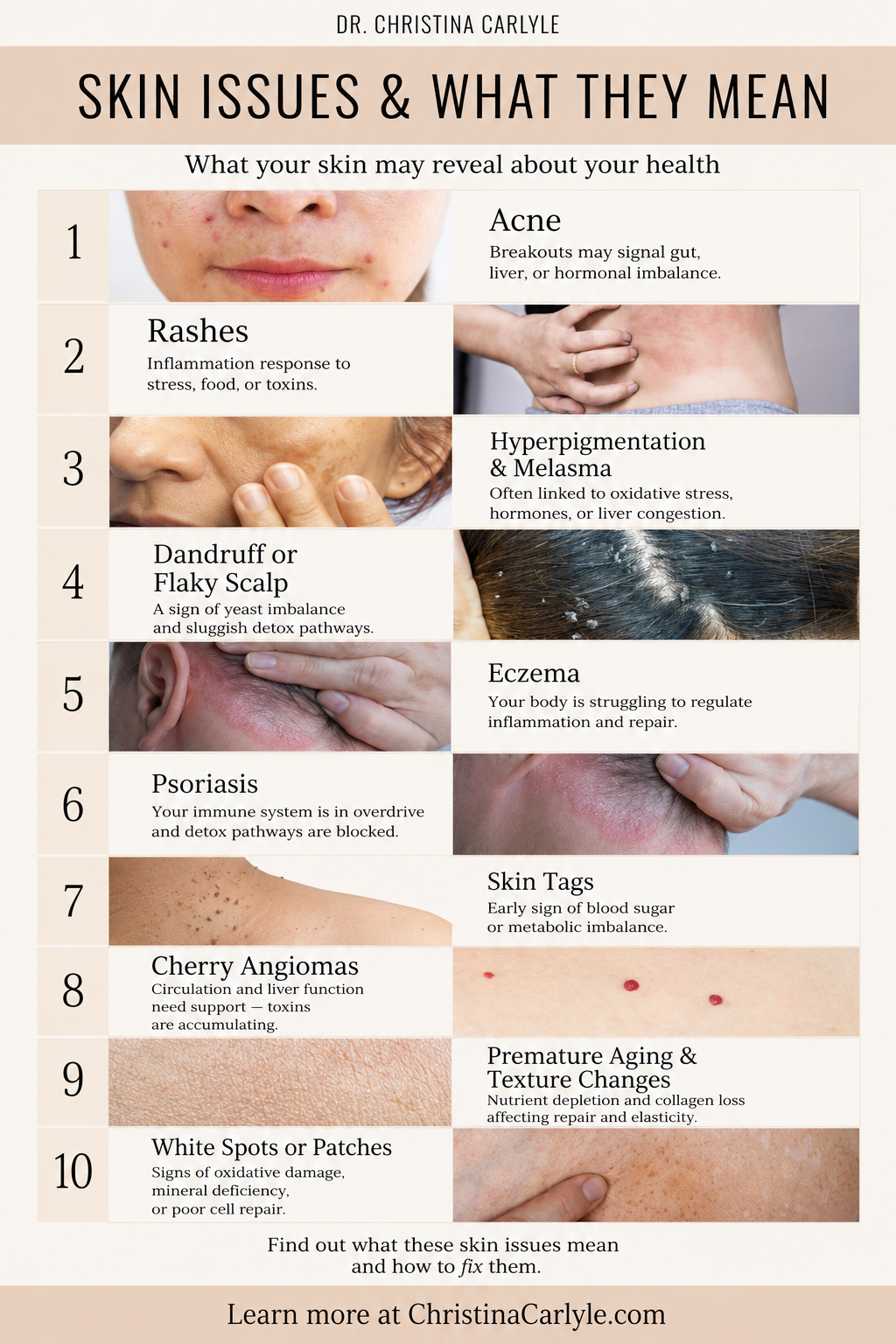 Pinterest infographic titled “Skin Issues & What They Mean” by Dr. Christina Carlyle showing common skin conditions including acne, rashes, hyperpigmentation, dandruff, eczema, psoriasis, skin tags, cherry angiomas, texture changes, and white spots, with notes about what these skin issues may reveal about gut health, liver function, hormones, detox, inflammation, and nutrient deficiencies.