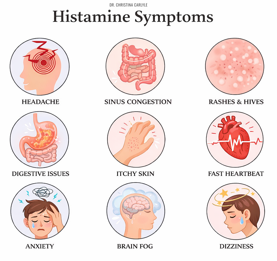 Histamine Symptoms Infographic showing common histamine symptoms including headaches, sinus congestion, rashes and hives, digestive issues, itchy skin, rapid heartbeat, anxiety, brain fog, and dizziness.