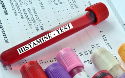 Histamine Intolerance: What It Is, Why It Happens, and How it Affects You