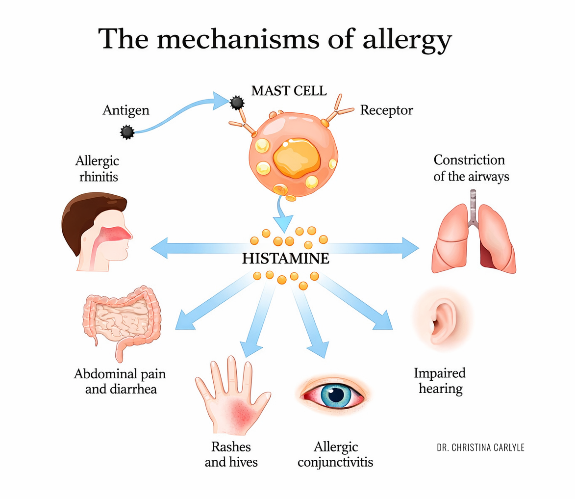 MCAS activation Medical infographic illustrating the mechanisms of allergy showing mast cells releasing histamine, with arrows pointing to symptoms including allergic rhinitis, airway constriction, abdominal pain, rashes and hives, allergic conjunctivitis, and impaired hearing.