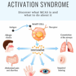 Infographic explaining MCAS mast cell activation syndrome showing mast cells releasing histamine and triggering symptoms like allergic rhinitis, airway constriction, abdominal pain, rashes and hives, allergic conjunctivitis, and hearing changes.