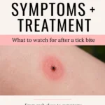 Pinterest pin for Dr. Christina Carlyle featuring a close-up tick bite image with a clean cream and pink design, titled “Tick Bite Symptoms + Treatment,” with text about what to watch for after a tick bite and recognizing rash clues and symptoms.