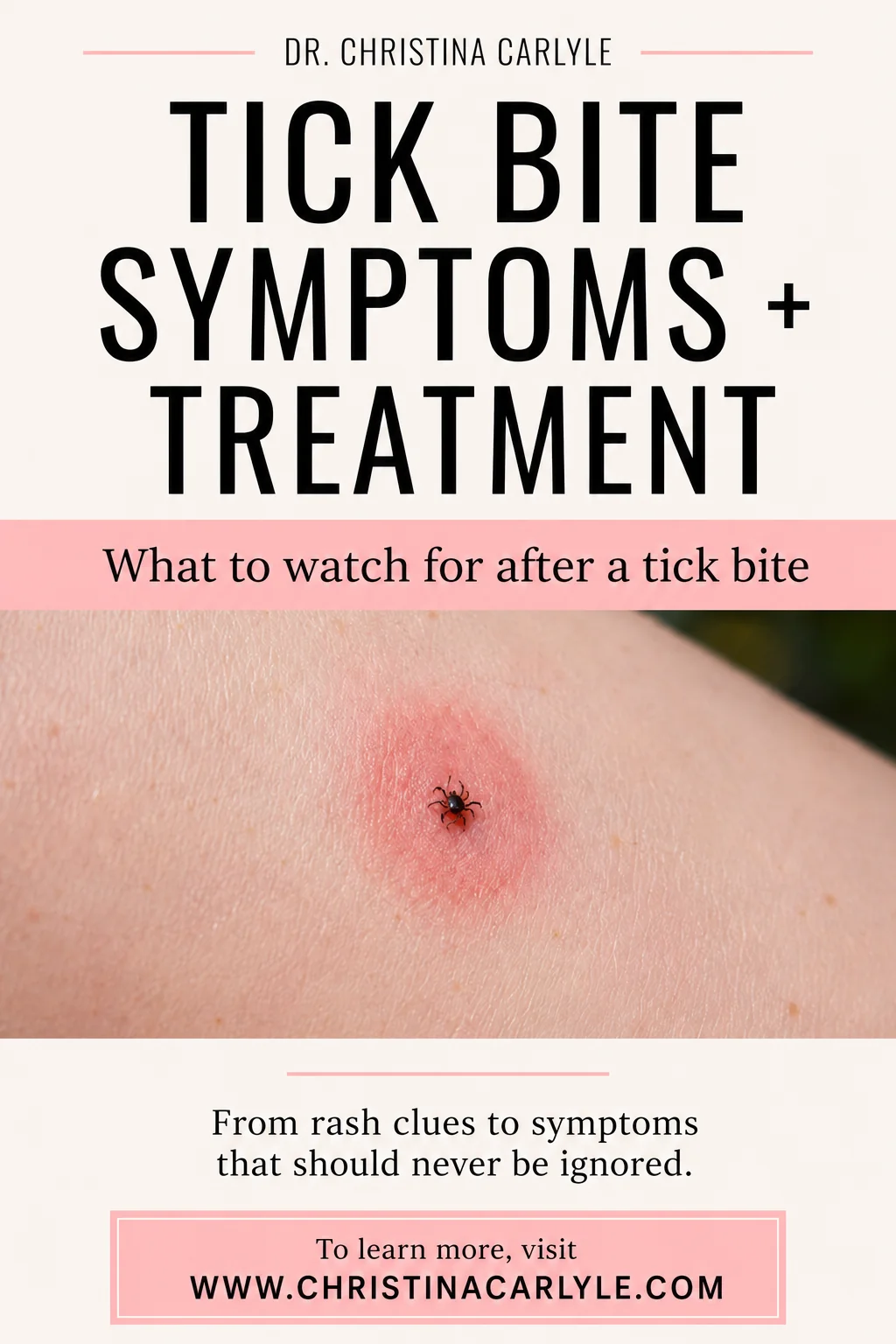 Pinterest pin for Dr. Christina Carlyle featuring a close-up tick bite image with a clean cream and pink design, titled “Tick Bite Symptoms + Treatment,” with text about what to watch for after a tick bite and recognizing rash clues and symptoms.